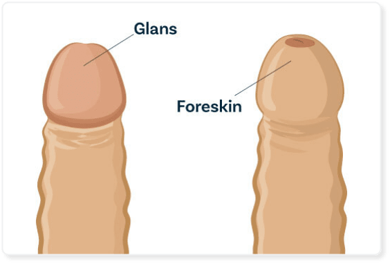 about-circumcision