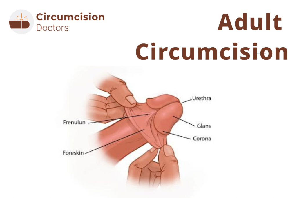 Adult Circumcision – Surgery Procedure, Types & Recovery