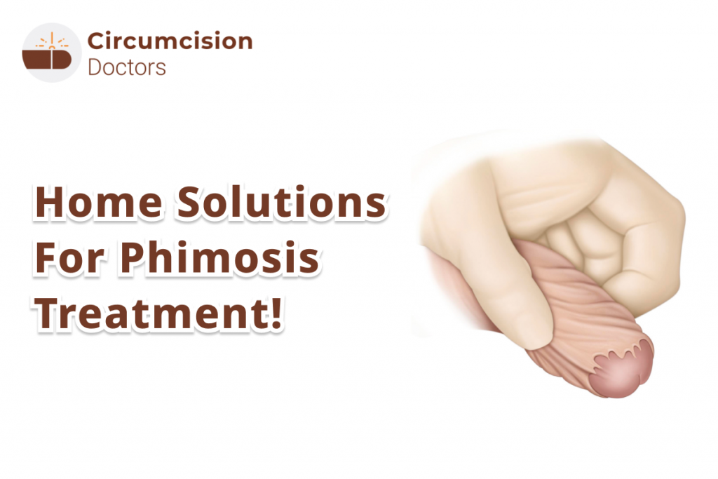 Tight Foreskin Home Solutions – Cure Phimosis at Home