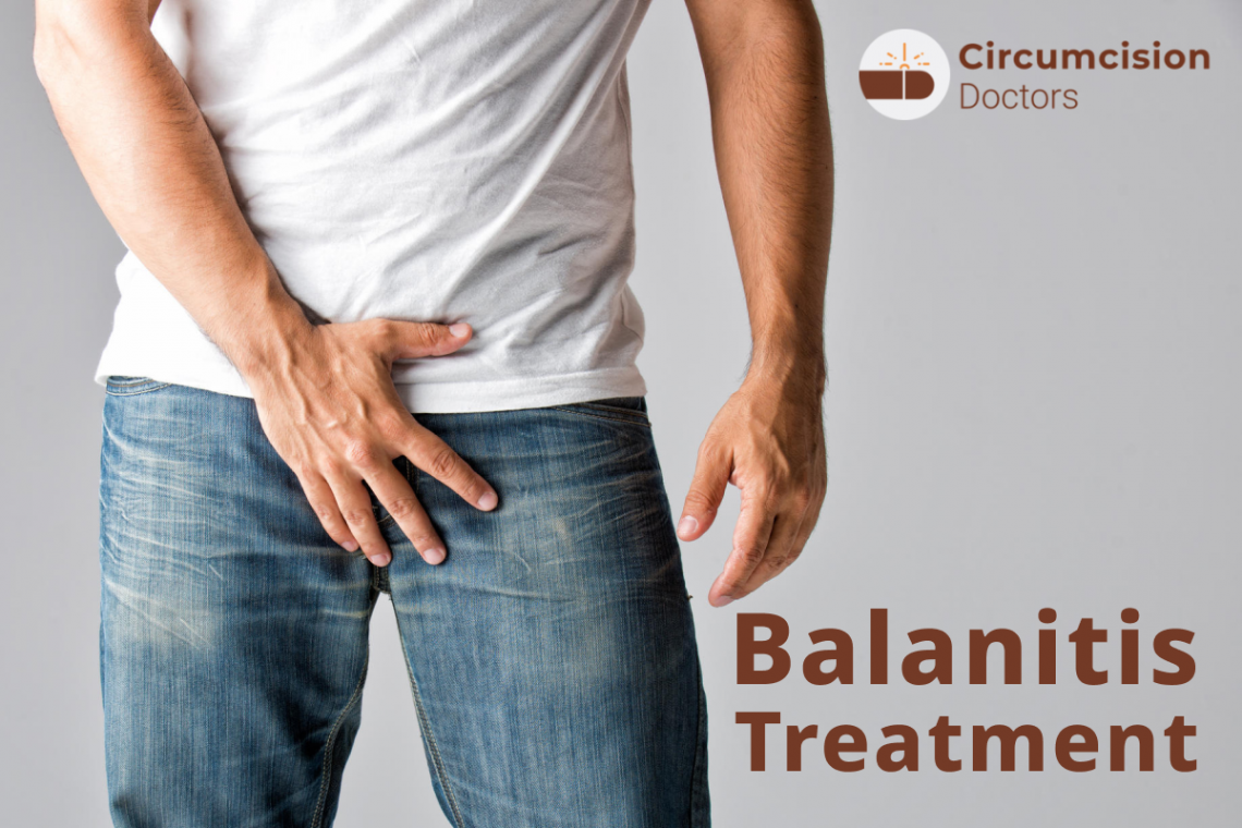 How To Treat Balanitis Balanitis SGTM