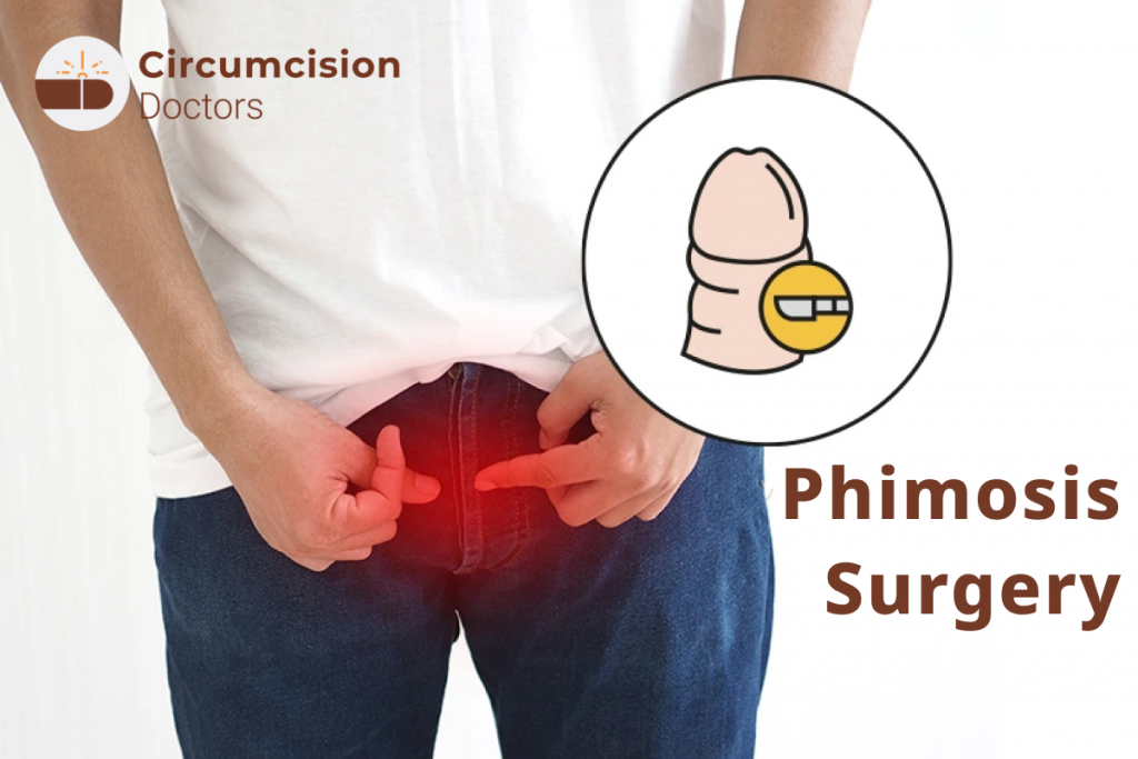 Phimosis Treatment – Surgery Procedure, Risks, and Benefits