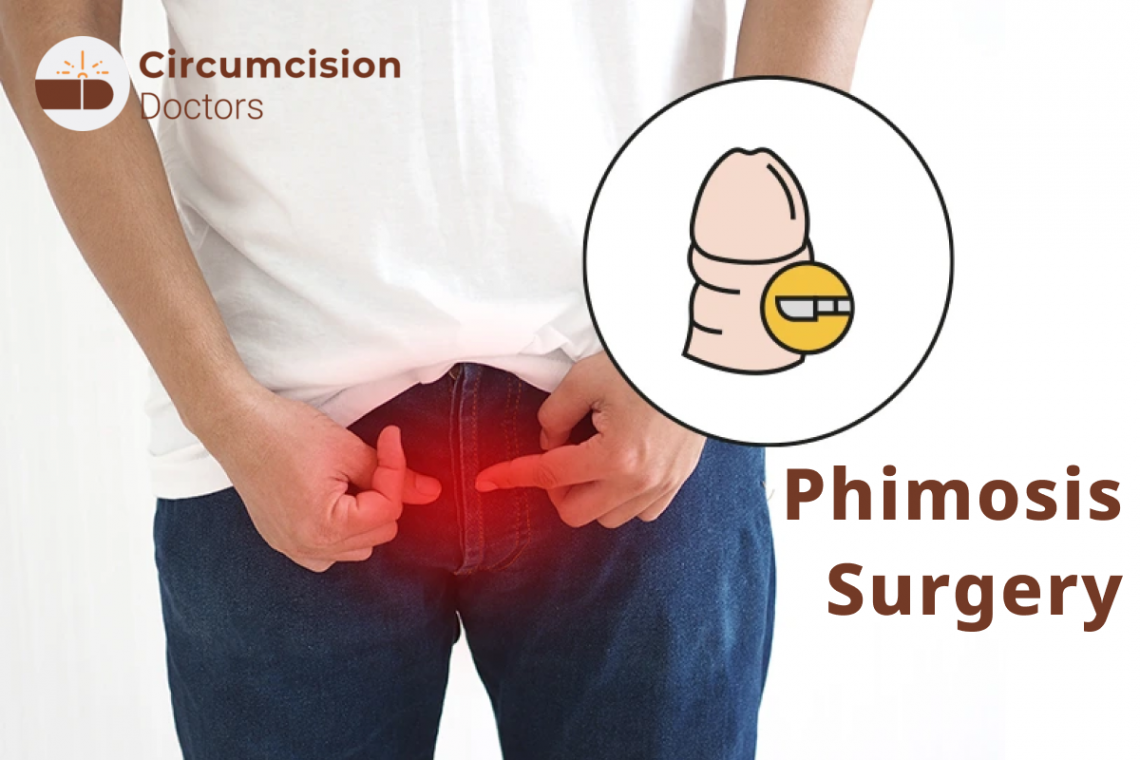 🏁 Operation for phimosis Kyiv, what is phimosis, treatment, symptoms,  stages, causes, consequences, circumcision for phimosis, clinic of urology  Kyiv, Urological practice