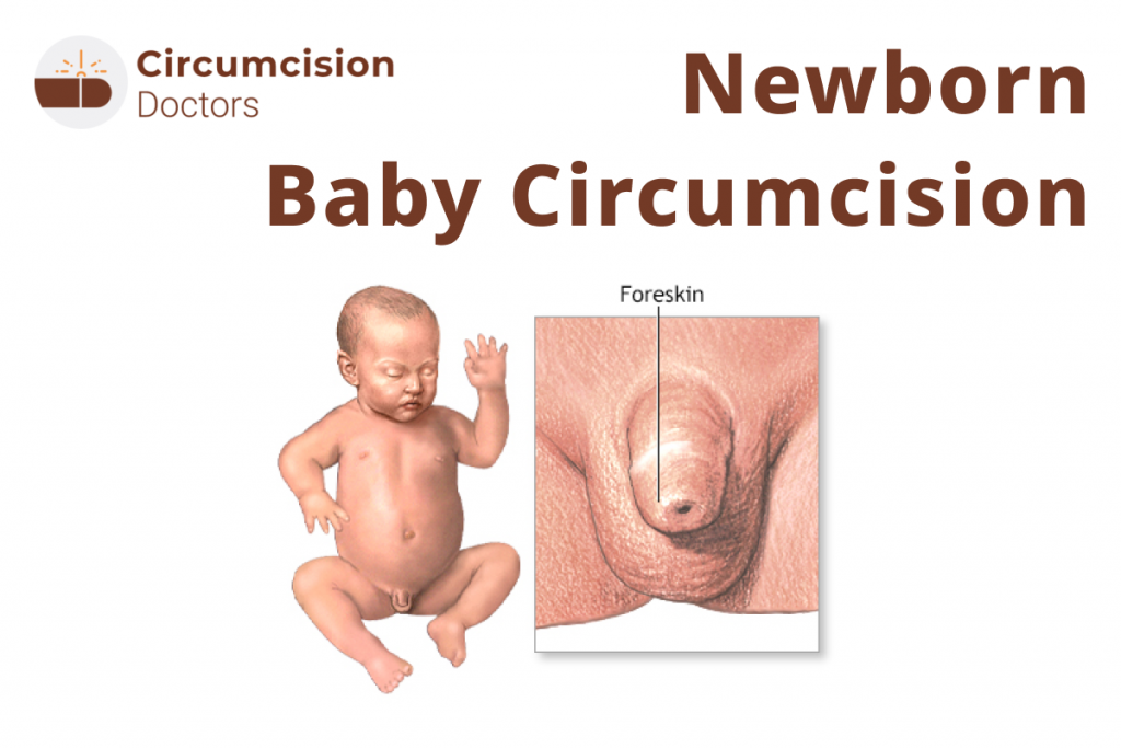 Newborn Circumcision: Procedure, Recovery, and Benefits