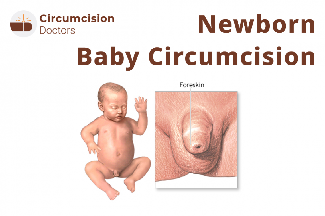 Newborn Baby Circumcision