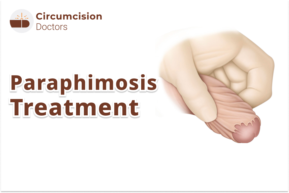 Paraphimosis Treatment