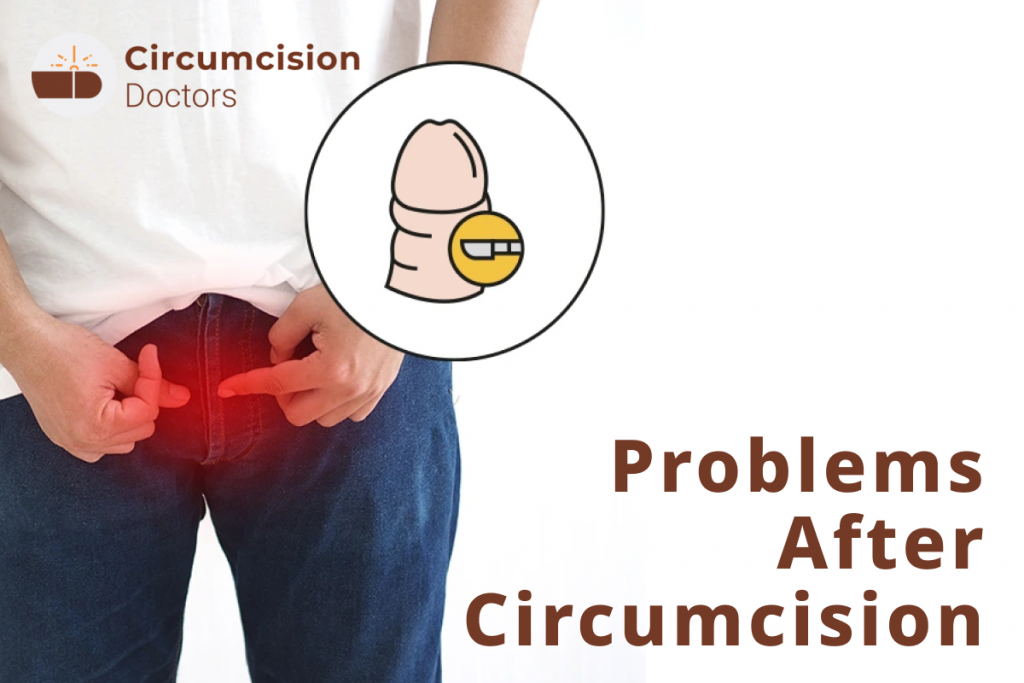 Problems After Circumcision – Potential Risks and Complications